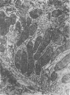 ������С����Ƥϸ��֮�����޼����е�������