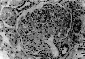 �����Խڶ�����С��Ӳ��