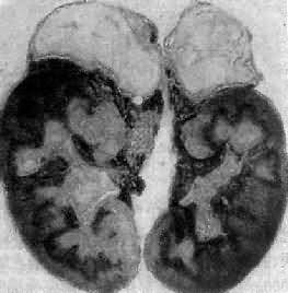 ˫�������ٽ��