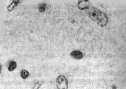 Alzheimer����ϸ��